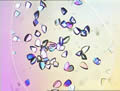 Proteinkristall